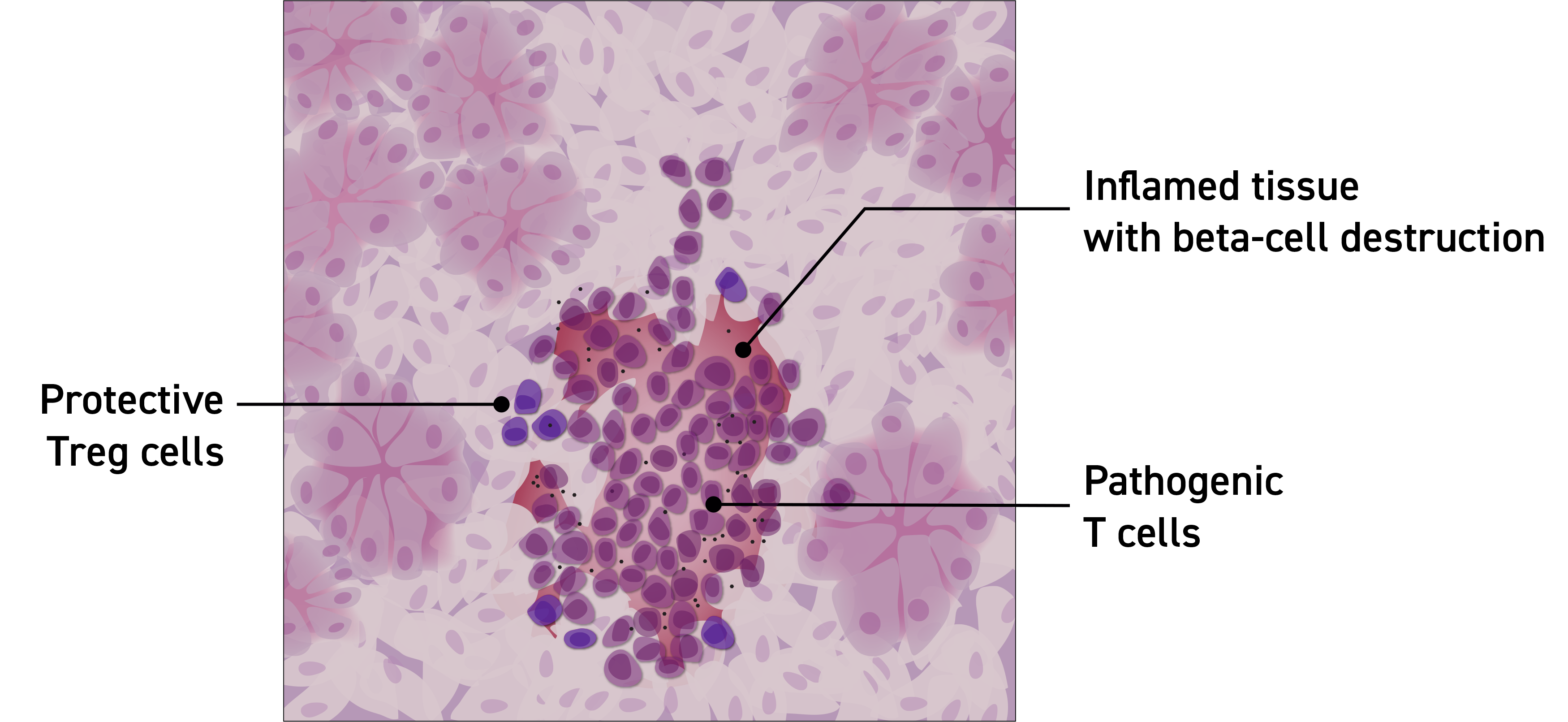 T cells in T1D